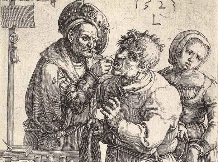 artistas dos Países Baixos; Lucas van LEYDEN (ca. 1489/1494-1533) DETALHE: O dentista, 1523. Gravura,11.7x7.5. The Metropolitan Museum of Art,